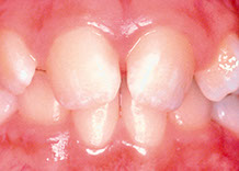 Before orthodontics image